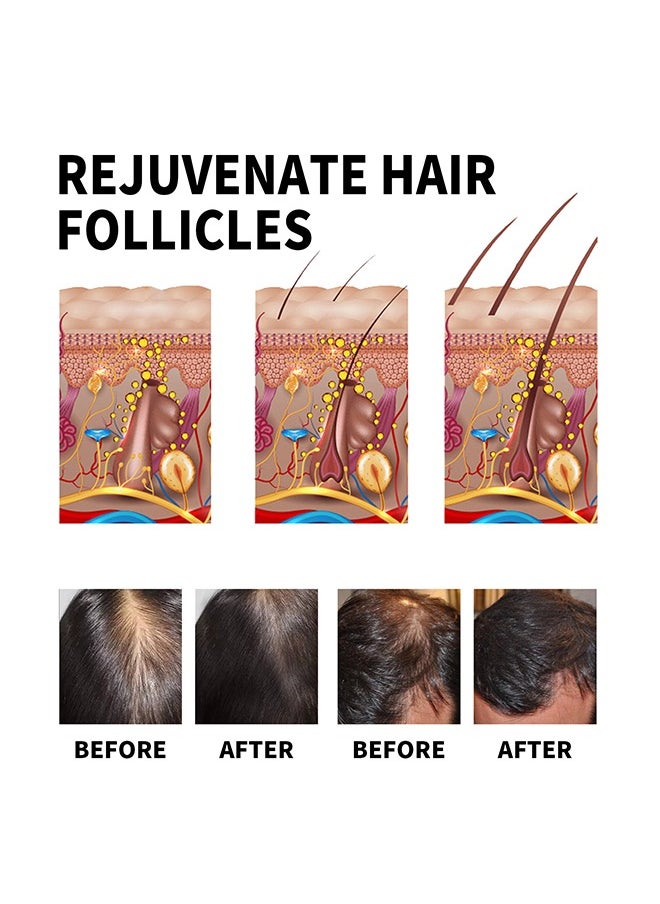 Jaysuing - Hair Loss Treatment Serum-Rosemary Tea Tree Oil Infused with Biotin, Nourishes and Moisturizes Hair, Dry Damaged Hair, Promotes Hair Growth & Scalp Health 60ml - Image 1