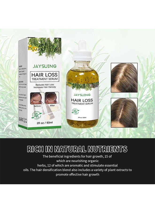 Jaysuing - Hair Loss Treatment Serum-Rosemary Tea Tree Oil Infused with Biotin, Nourishes and Moisturizes Hair, Dry Damaged Hair, Promotes Hair Growth & Scalp Health 60ml - Image 1