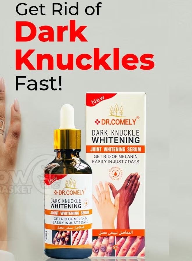Dark Knuckle Joint Whitening Serum 50ml Skin Brightening Spot Remover for Elbows Knees Underarms Hands Natural Formula
