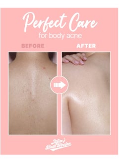 Mom's Best Friend Mom'S Bath Recipe Body Peeling Pad Trouble (8ea)  - Image 4