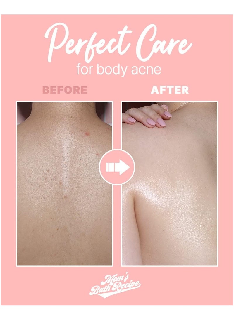 Mom'S Bath Recipe Body Peeling Pad Trouble (8ea)