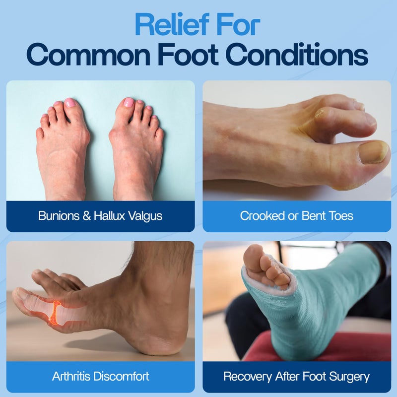 benoo Bunion Corrector for Women & Men (2 Pack) Hammer Toe Straightener, Bunion Relief, Big Toe Separator, Adjustable Day & Night Support, Comfortable, One Size Fits All - Image 5