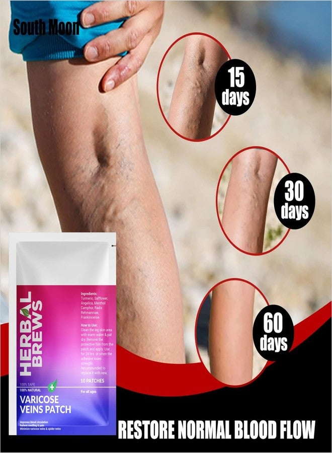 المشروبات العشبية مشروبات عشبية - لصقات لعلاج الدوالي مع الكركم ومكونات طبيعية لتخفيف فوري | تنعيم الأوردة، تقليل التورم وتسكين الألم، تخفيف التشنجات والحكة والتورم | تحسين الدورة الدموية - 10 لصقات - Image 4
