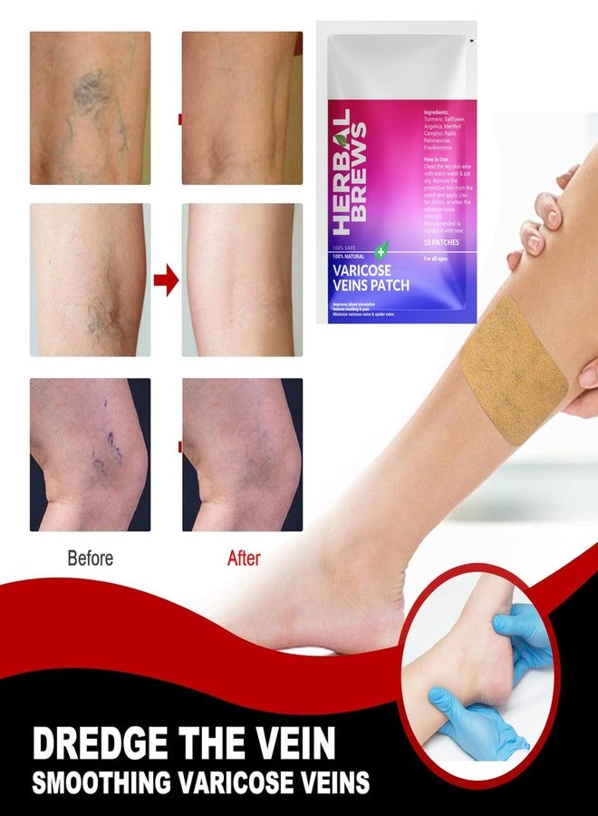 المشروبات العشبية مشروبات عشبية - لصقات لعلاج الدوالي مع الكركم ومكونات طبيعية لتخفيف فوري | تنعيم الأوردة، تقليل التورم وتسكين الألم، تخفيف التشنجات والحكة والتورم | تحسين الدورة الدموية - 10 لصقات - Image 3