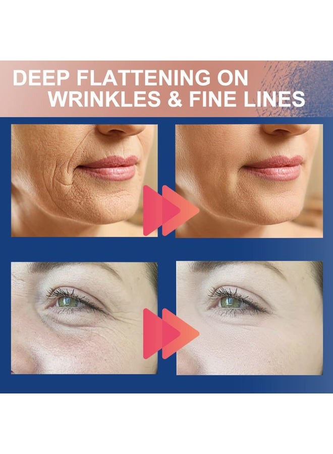 Akissos 2 Rolls Anti Wrinkle Patches Face Patches Neck Patches Unisex For Firming and Tightening Skin 2.5cm*5m - Image 5