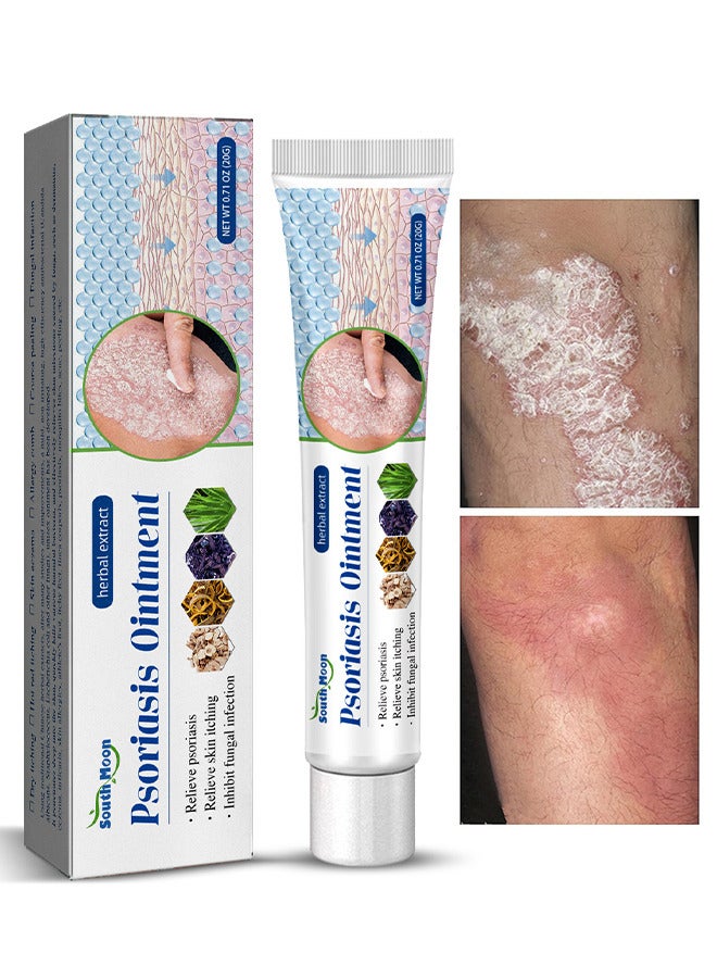 ساوث مون مرهم الصدفية المستخلص العشبي - مرهم جلدي مضاد للحكة عالي الجودة للحكة 20 جرام مرهم موضعي للتمريض - Image 1