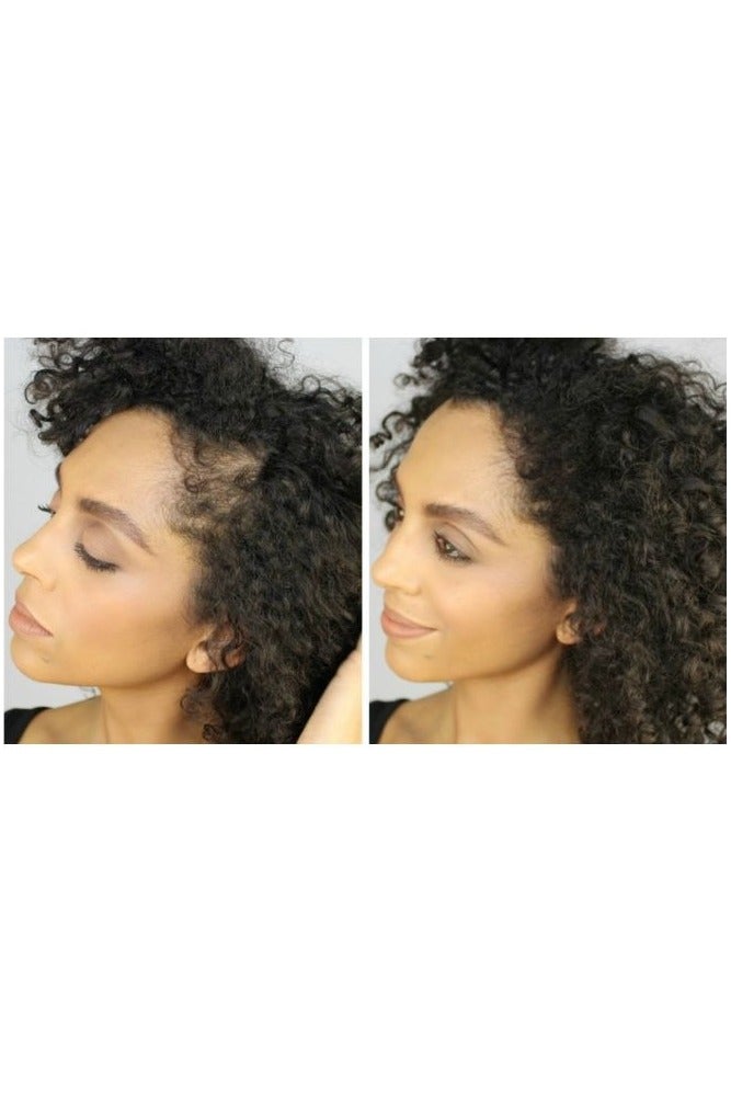 XFusion by Toppik Hair Building Fibers Black 27.5g Fill In Fine or Thinning Hair, Instantly Thicker, Fuller Natural Looking Hair - Image 2