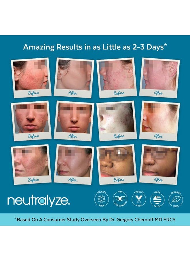 Neutralyze Maximum Strength Acne Face Wash With 2% Salicylic Acid & 2% Mandelic Acid, Medical Grade AHA + BHA Facial Cleanser for Acne Prone Skin (90+ Day)  - Image 3