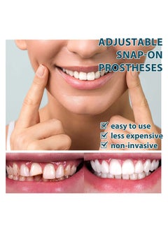 EELHOE Adjustable Snap-on Dentures Temporary Teeth Repair Kit Correct Denture Alignment for Temporary Teeth Replacement  - Image 4