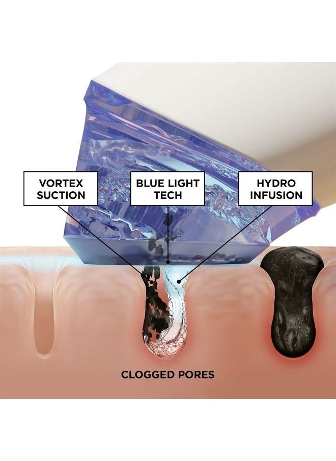 BeautyBio - GLOfacial Hydro-Infusion Deep Pore Cleansing + Blue LED Clarifying Tool - Image 1