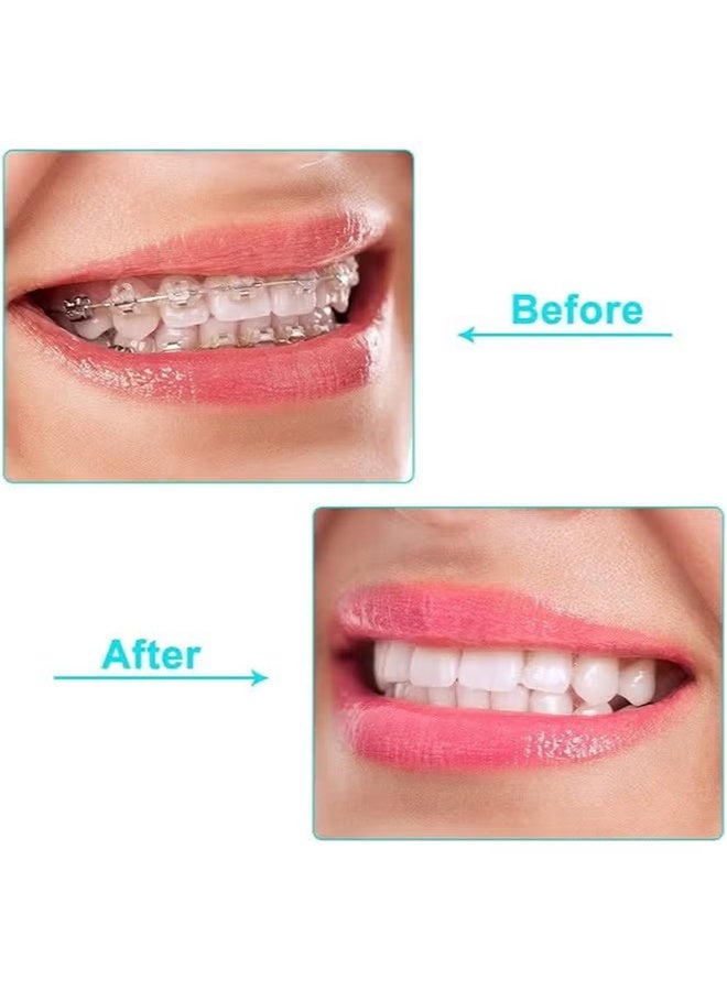 JS 10 Pcs Orthodontic Aligner Chewies for Aligner Chompers Aligner Trays Seaters, Compatible with Invisalign Braces, White - Image 5