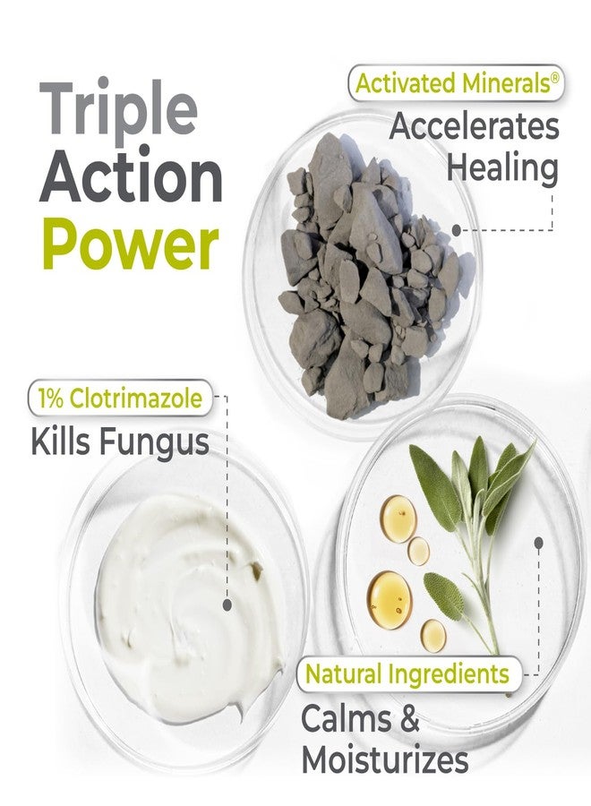 تيراسيل كريم تيراسيل كلوتريمازول المضاد للفطريات، لعلاج عدوى الخميرة الفطرية، وحكة الجوك، وقدم الرياضي، والسعفة، للرجال والنساء، علاج مثبت سريريًا لفطريات الجلد. مؤهل لـ FSA-HSA (أونصة واحدة) - Image 5