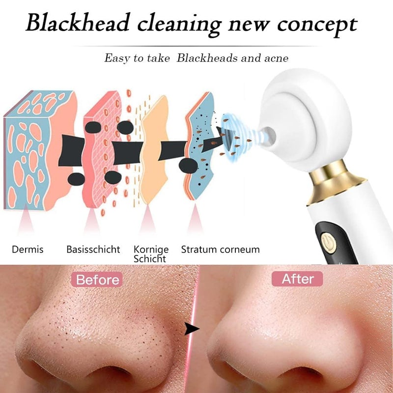 FLOITTUY Blackhead Remover Beautiful Skin Care Expert Acne Pore Cleaner Vacuum Blackhead Remover Kit Skin Cleaner Pimple Removal Tool 3 In 1 MultiFunction Blackheads - Image 3