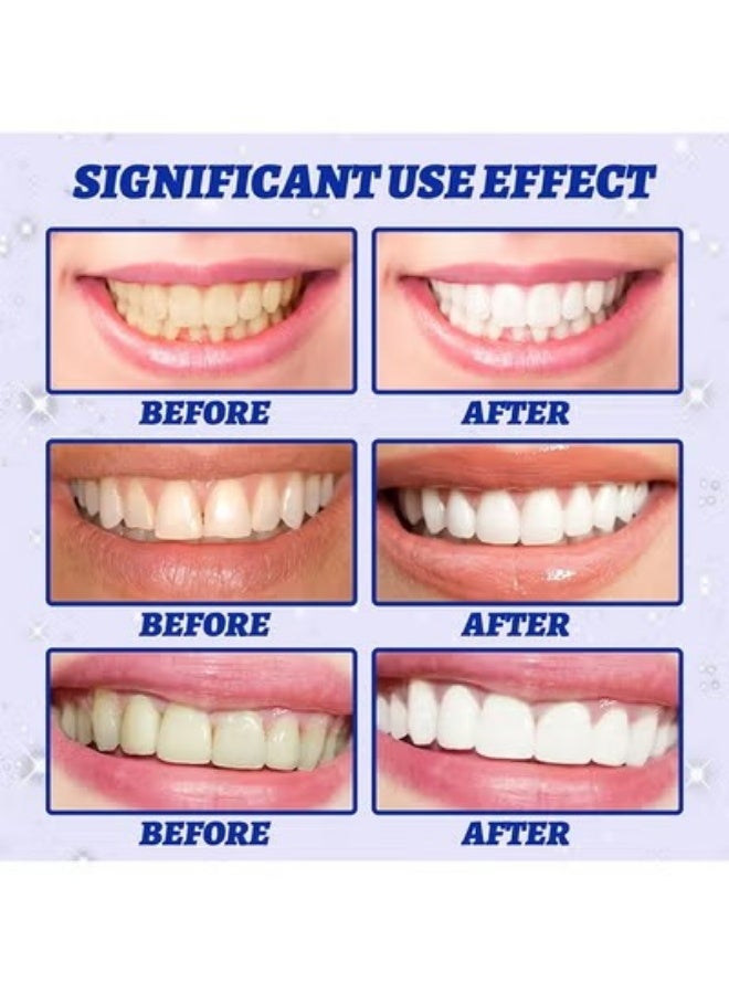 5D White Teeth Whitening Strips ,Teeth Whitening kit,eeth Cleaning Tools,Advanced Fast Effective Significant Whitening Comfortable,for Cleaning Teeth Stains Coffee Stains Dental Plaque 5PCS - Image 2