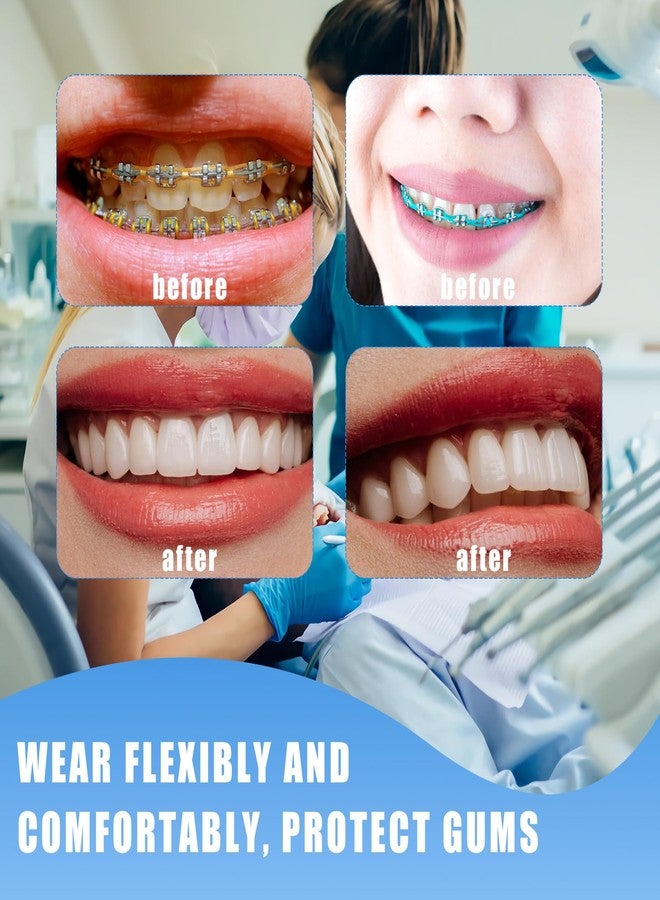 SEAVERRS سلسلة تقويم أسنان بطول 20 سم، سلسلة مطاطية متصلة بـ 24 لونًا مع أداة، أربطة تقويم أسنان قابلة لإعادة الاستخدام للمراهقين والبالغين، ملحق للعناية بالفم يمكنك تركيبه بنفسك - Image 5