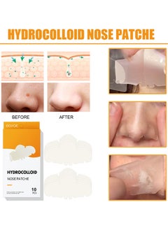 EELHOE Blackhead Pore Strips, Deep Cleansing, Face Nose Pores 10 Strips  - Image 2
