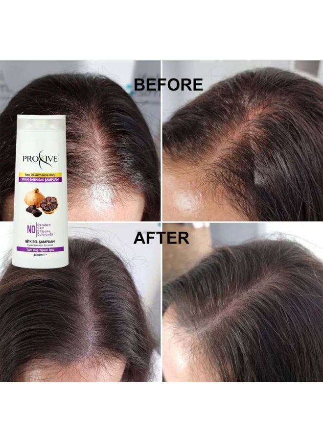 PROXIVE PROXIVE Against Hair Loss/Hair Growth/Herbal Shampoo/Scalp Care/Dandruff/Anti Hair Fall  SALT-FREE - PARABEN-FREE - SILICONE-FREE - PAINTLESS Herbal Black Garlic Shampoo 400 ml/MADE IN TURKEY - Image 3