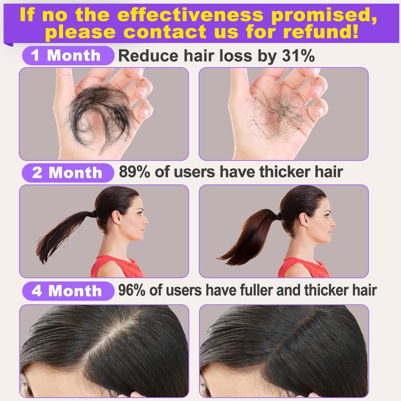 GOLDWORLD Rosemary Oil for Hair Growth,2 Pack Growth Serum Products w/Scalp Massager Castor Biotin Argan Thinning Dry Damaged Ingrown Regrowth Loss Treatment Women Men - Image 2