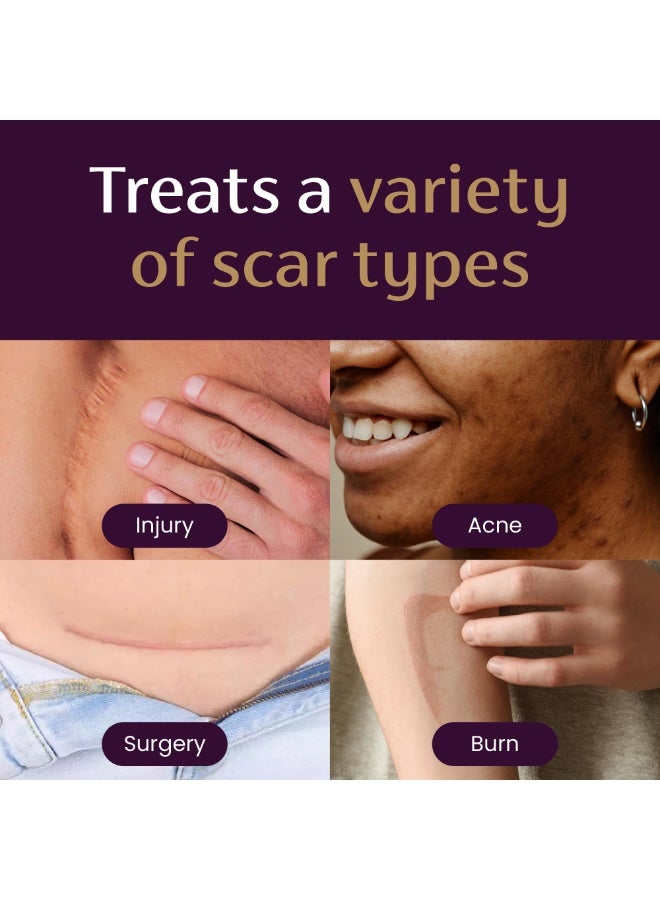 Mederma Intensive Overnight Scar Cream, Works with Skin's Nighttime Regenerative Activity, Clinically Shown to Make Scars Smaller and Less Visible, 1.0 Oz (28g) - Image 3