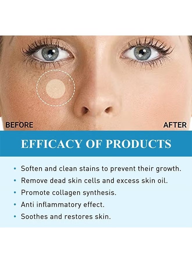 SOUTH MOON 144 Pcs Milia Remover Patch,Remove Fat Granule Eye Patch, Remove Oil Granule Eye Patch Under The Face, Nourish Eye Cream, Moisturize Repair and Smooth Eye Patch  - Image 5