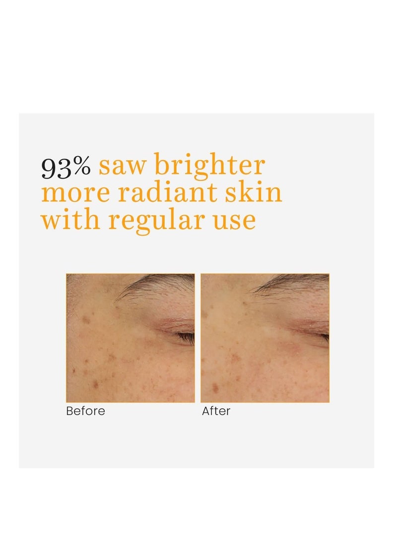 O3+ جل كريم O3+ فيتامين C والكركم للتألق 50 جرام - Image 4