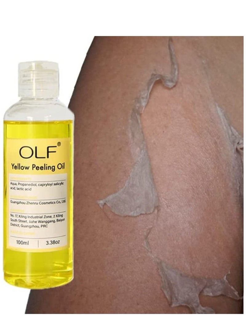 Yellow Peeling Oil 100ml Super Strength Dead Skin Remover Skin Moisturizing Hydrating Butter Peeling Remove Dead Skin and Calluses on Feet and Hand Dark Spot Peeling Oil Unisex