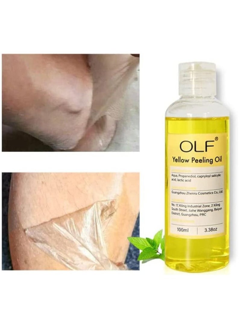 Yellow Peeling Oil 100ml Super Strength Dead Skin Remover Skin Moisturizing Hydrating Butter Peeling Remove Dead Skin and Calluses on Feet and Hand Dark Spot Peeling Oil Unisex
