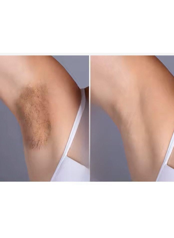 روميكس " روميكس - إس " كريم تفتيح المناطق الحساسة (تحت الإبط ومنطقة البكيني ) الطبيعي 50 جم - Image 3