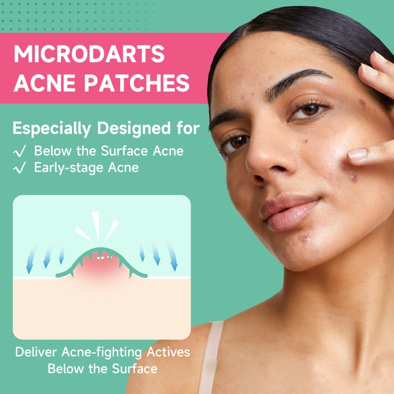 TEAWOO 18-Count Microdart Pimple Patches, Hydrocolloid Acne Patches with Salicylic Acid & Madecossoside, Microdart Zit Patches for Deep Blemishes & Early Stage Acne (Patented) - Image 2