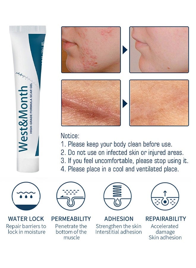 West&Month High-Grade Formula Scar Gel, Fade Scar Gel, Smooth Skin Care Gel,Scar Repair For Scar Pregnancy Surgery, 20g  - Image 5