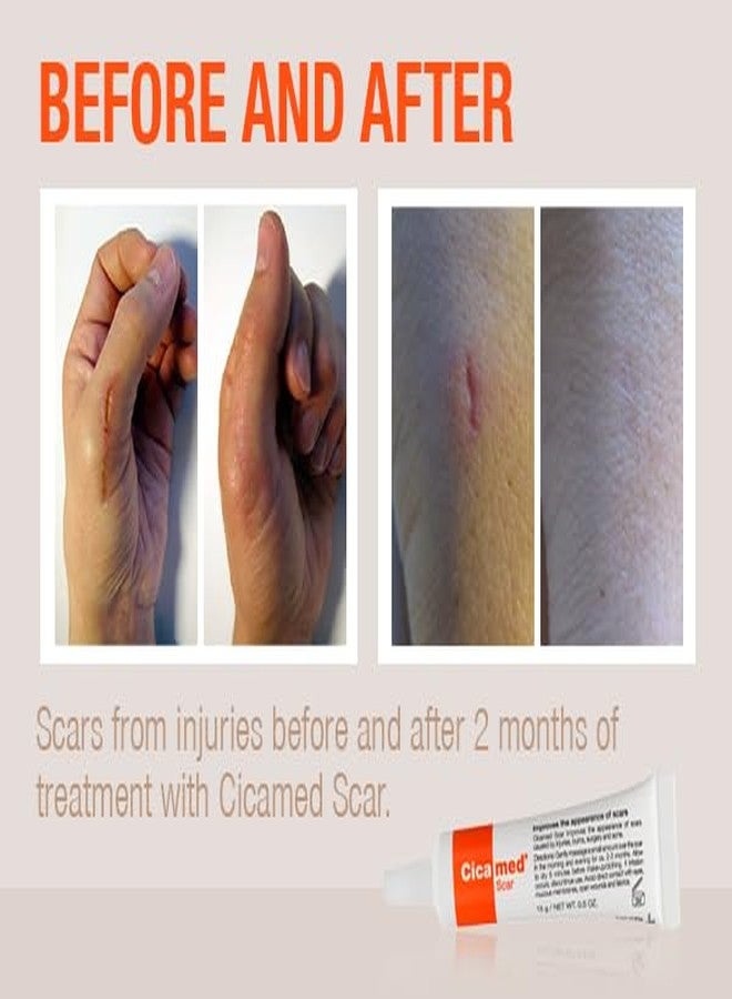 Cicamed Silicone Scar Gel - Works with Tape - Advanced Cream for Surgical Scars, C-Section, Burns, Keloids, and Acne Marks - 0.5 oz (15g) - Image 4