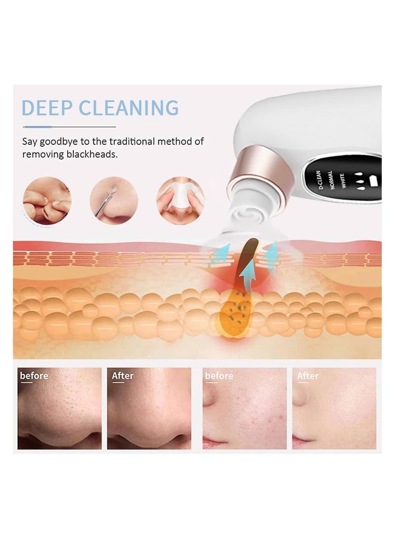 مكنسة كهربائية فائقة الصغر لازالة الرؤوس السوداء والمسام - مكنسة كهربائية للرؤوس السوداء، اداة استخراج الرؤوس السوداء، جهاز كوميدو لازالة الرؤوس السوداء - Image 4