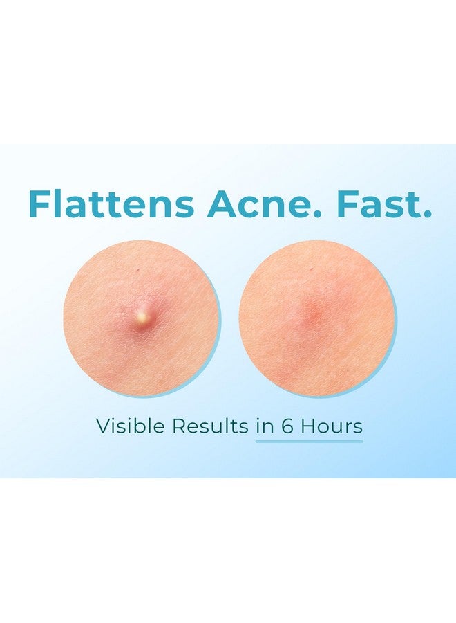 Cleof Hydrocolloid Pimple Patches (Made in Korea) FSA/HSA Eligible, Vegan, Hypoallergenic, Cruelty-Free | Acne Stickers, Overnight Treatment - for Zits, Spots, Pimples, Whiteheads (46 Count, Mixed Sizes) - Image 2