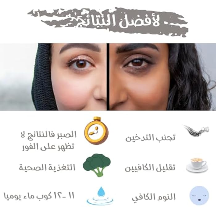 Astroida Eye Contour Cream 30ml 1fl Oz With Hyaluronic acid, Vitamin A,E,C & Caffeine - Anti Aging - Anti Wrinkles, Anti Dark Spots, Sun Protection - Image 4