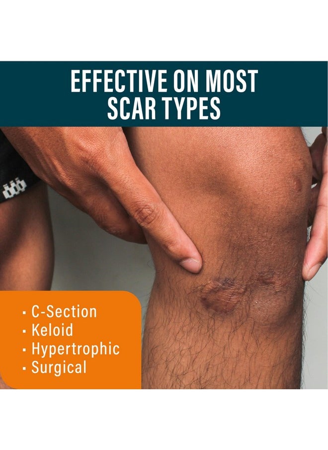 Nuvadermis - Scar Gel - Retinol, Allantoin, Vitamin E, Betaine - For C-Section, Tummy Tuck, Keloid Scar - Post Surgery Scar Management - 1.7 Oz Scar Treatment Gel - C Section Recovery Silicone Scar Gel - Image 1