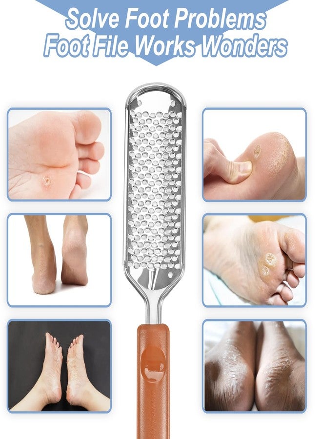 Untrytb Professional Foot Scrubber Dead Skin Remover, Pedicure Foot File Callus Removal, Heel Scraper for Cracked Heels, Microplane Cheese Grater for Feet, Foot Rasp for Hard Skin(T1) - Image 3