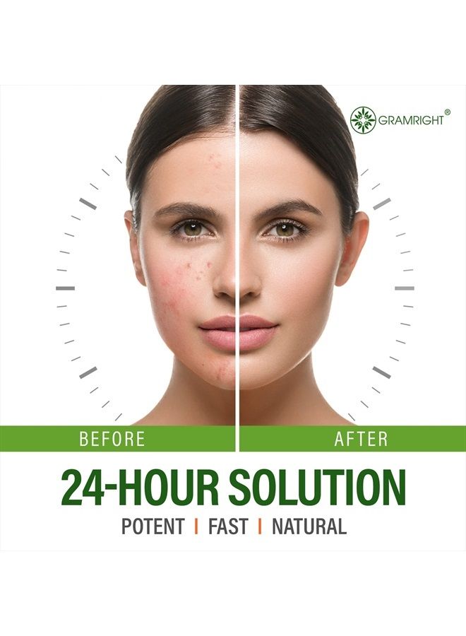 GRAMRIGHT Acne Treatment Face Cream 4 fl.oz - Acne Spot Treatment for Face & Acne Dots - Tea Tree Oil for Acne - Natural Cystic Acne Treatment - For All Skin Types - Premium Acne Scar Cream & Pimple Remover - Image 3