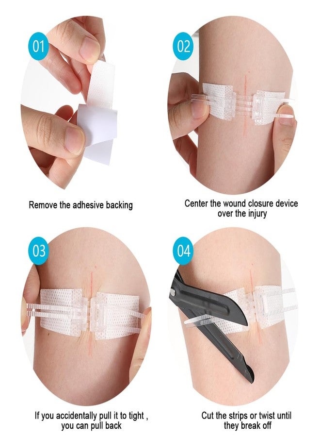 XYYLLL Wound Closure Strips, Wound Suture Strip for Sterile Skin, 5 Pieces, First Aid Adhesive Stitches, Suture Bandages, Emergency Stitch Laceration Closure - Image 4