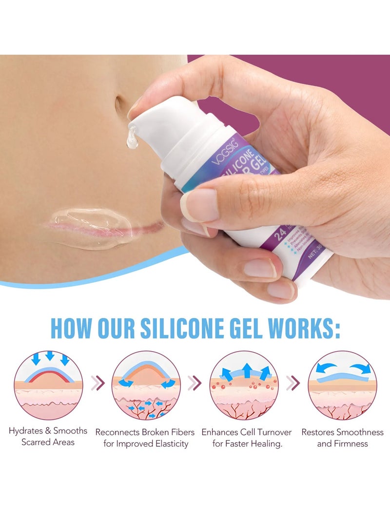 VOGSIG Silicone Scar Gel for Damaged Skin Dead Skin Elimination Surgery Scar Burns Acne Scars and Pregnancy Lines Deeply Moisturize Hydrates Smooths New and Old Scars Scar Removal Cream Gel 30g - Image 4