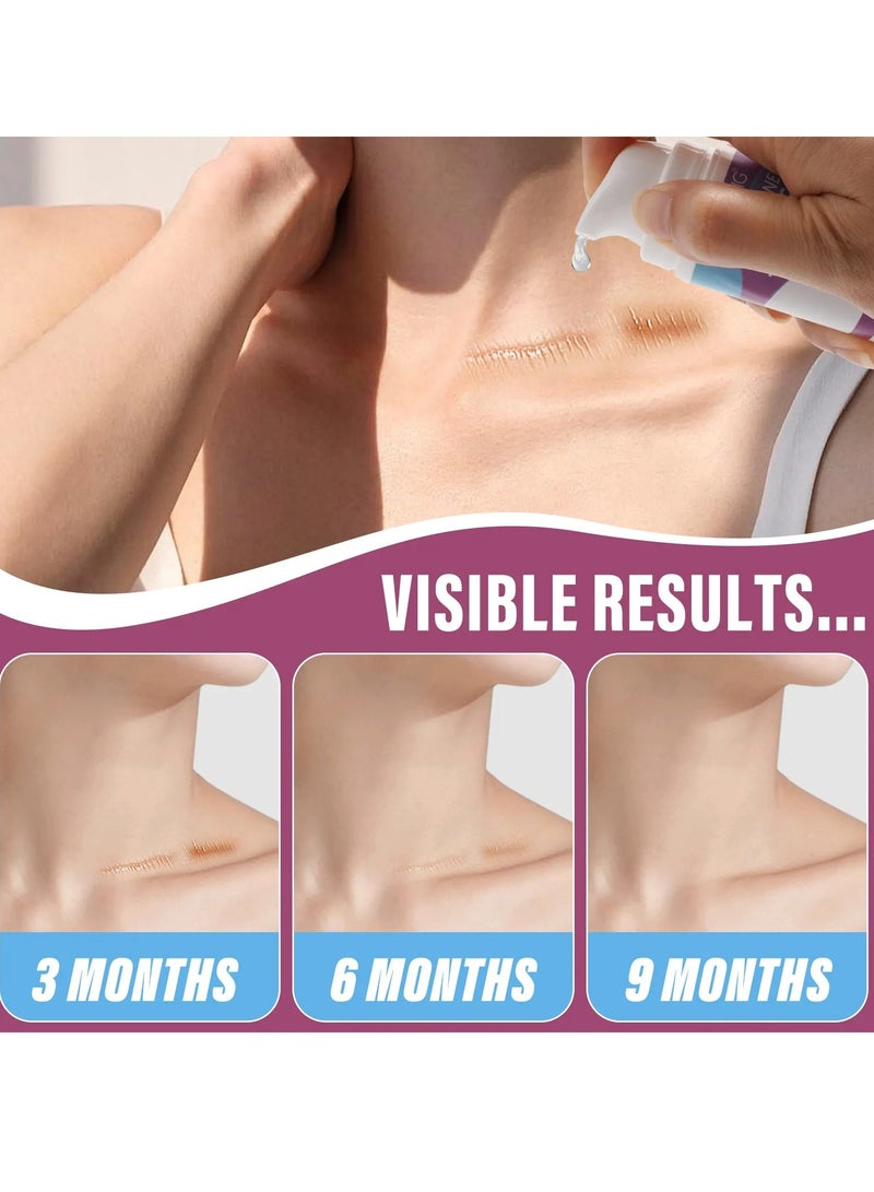 VOGSIG Silicone Scar Gel for Damaged Skin Dead Skin Elimination Surgery Scar Burns Acne Scars and Pregnancy Lines Deeply Moisturize Hydrates Smooths New and Old Scars Scar Removal Cream Gel 30g - Image 3