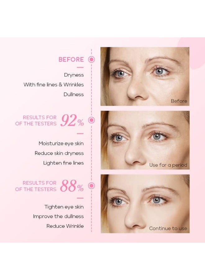 فيني يلا جوي سيروم رولر للعيون بنكهة زهر الكرز، مرطب للعيون بتركيبة عميقة الترطيب مع الكافيين والصوديوم هيالورونات، كريم تحت العين للحد من الهالات السوداء والخطوط الدقيقة، علاج للعناية بالبشرة لنعومة تامة. - Image 5