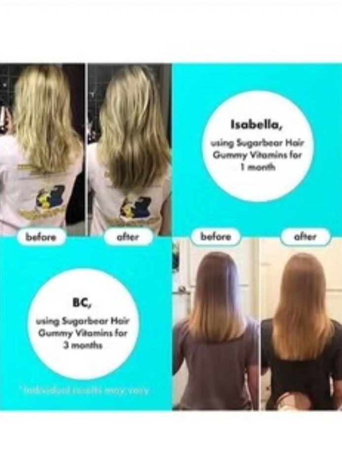 Sugar Bear hair vitamins
