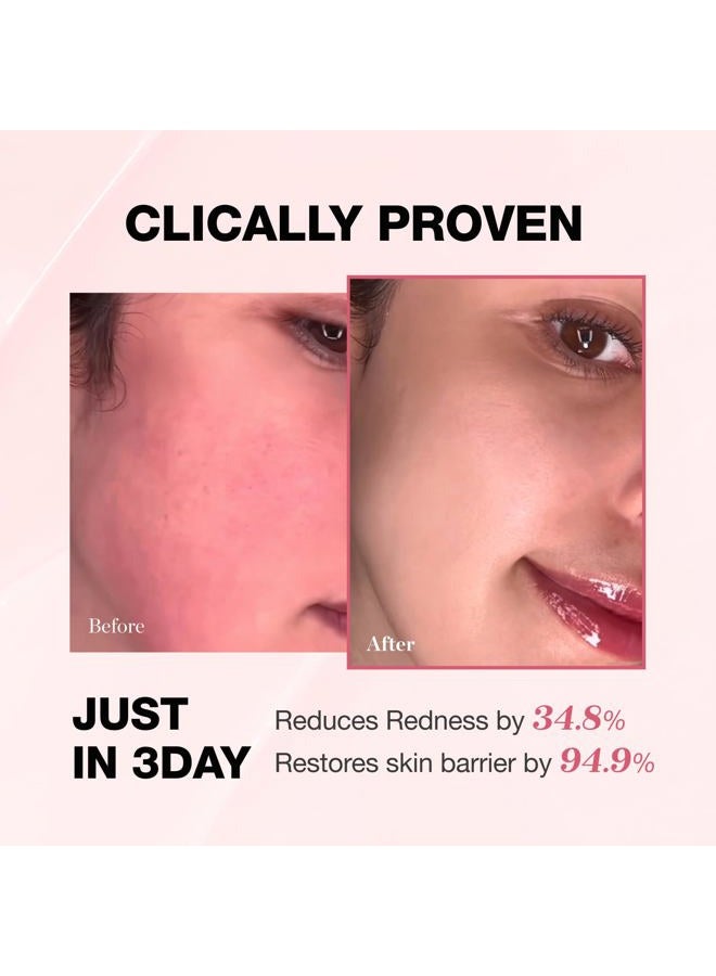 Physiogel Calming Relief Facial Cream, Reduces Redness in 30 mins, Moisturizer for Men & Women, For Dry, Red, Itchy, Sensitive Skin, Strengthens Skin Barrier, Free of Fragrance,Dermatologically Tested - Image 4
