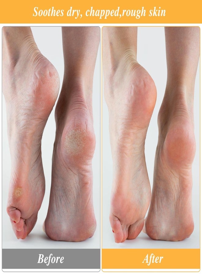 Aster 3 Pairs Moisturizing Socks for Dry Feet, Cracked Heel Repair - Overnight Lotion Cotton Socks, Gel Spa Moisture Enhancing for Women and Men, White - Image 5