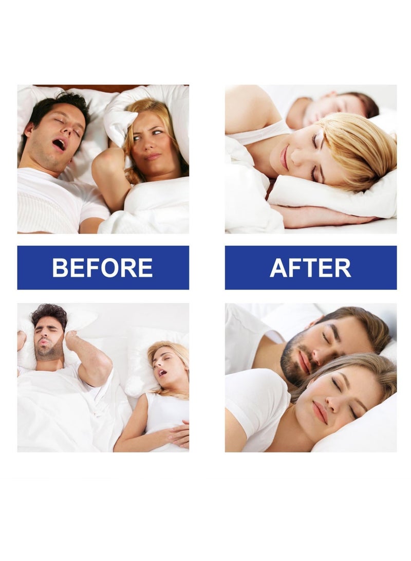 Sleep Tape Strips 30 Pcs Mouth Tape for Restful Sleep Anti Snoring Solution for All Reusable Hypoallergenic Quality Strips Easy Removal - Image 3