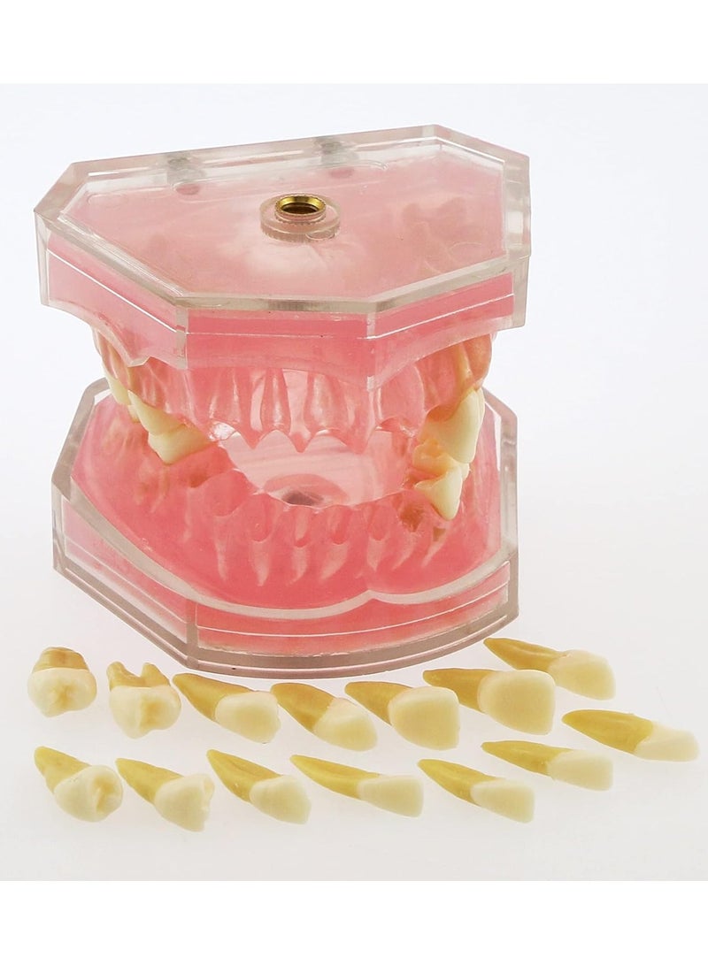 Ru syanl Dental Demonstration teeth Model Standard Study Teaching dental mode with all Removable Teeth Soft and Bendable Teeth  - Image 5