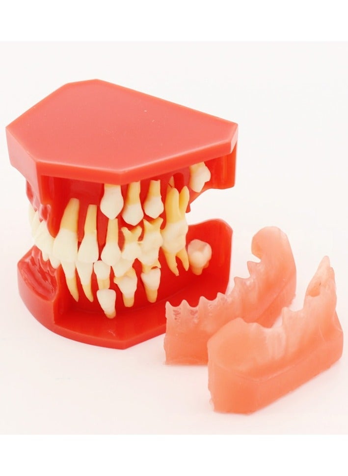 Dental Children's Teeth Replacement Teaching Model 9-12 years old