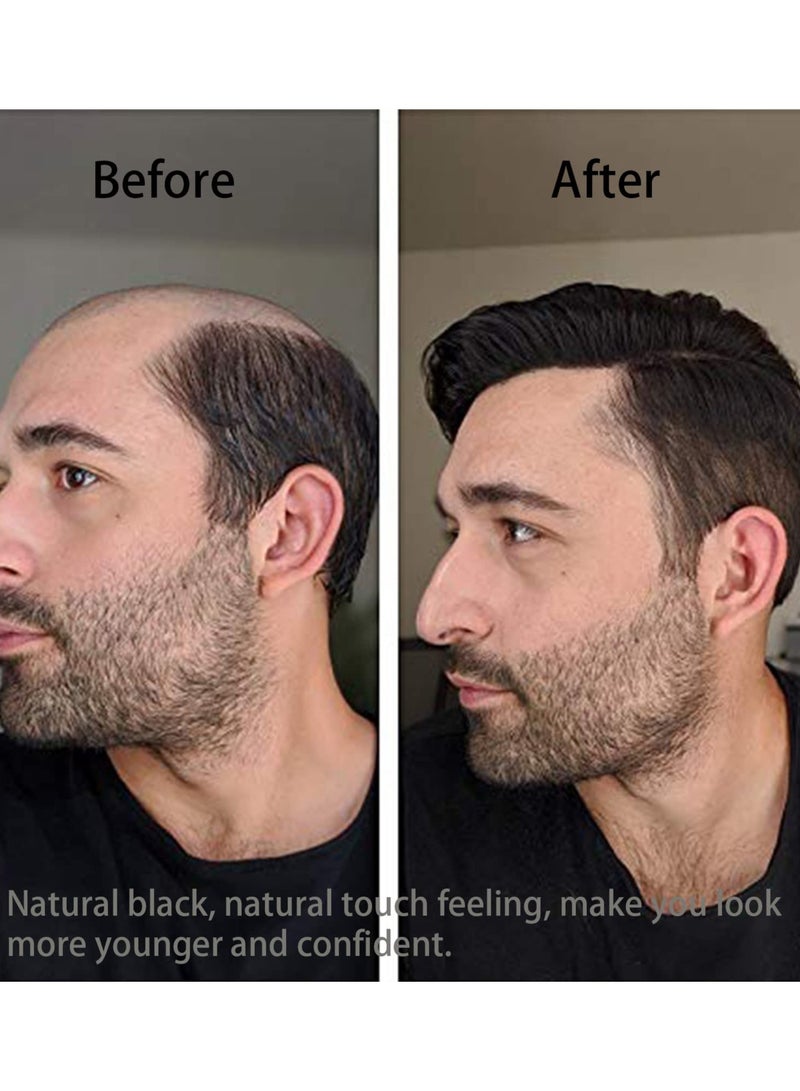 Excefore Men's Clips-On Short Hair Toupee, European Human Hair Toppers Hairpiece for Head Top Replacement System in Black, Perfect for Weddings, Parties, and Daily Use - Image 2