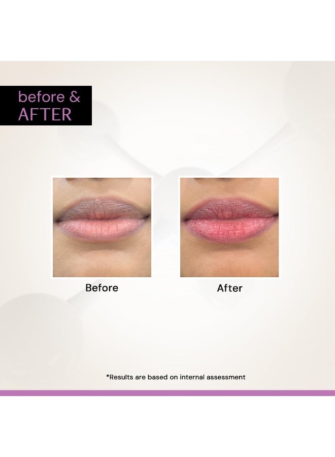 Deconstruct Brightening Tinted with SPF 30 | For Dark, Pigmented, Dry, Flaky Lip | SPF 30 for Sun Damage and Discoloration | Lip Balm for Glossy Buttery Soft Pink Lips | For Women & Men - (4 gm) - Image 3