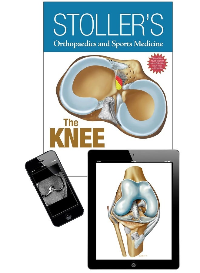 Stoller's Orthopaedics and Sports Medicine: The Knee: Includes Stoller Lecture Videos and Stoller Notes  - Image 2